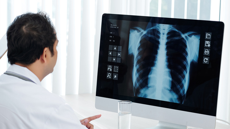 doctor examines lung x-ray