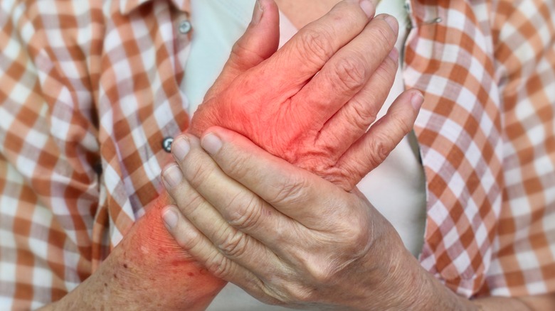 man massages inflamed hand