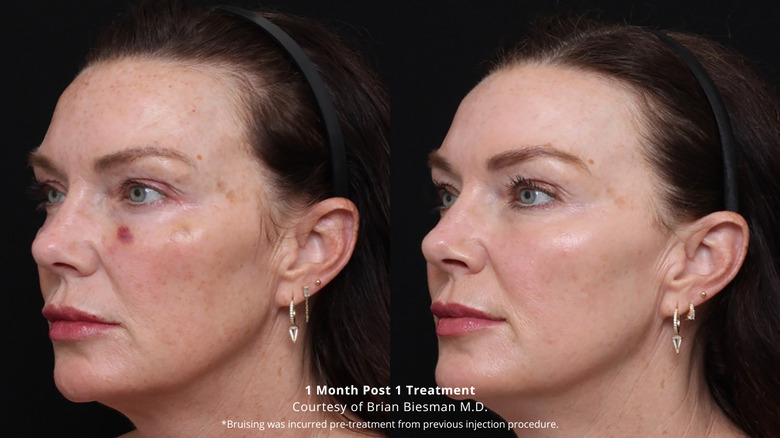 Comparison shot of treatments