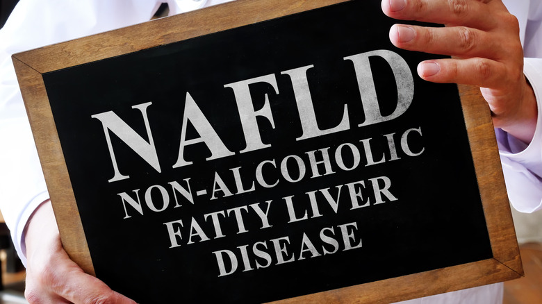 Doctor holding chalkboard sign with NAFLD
