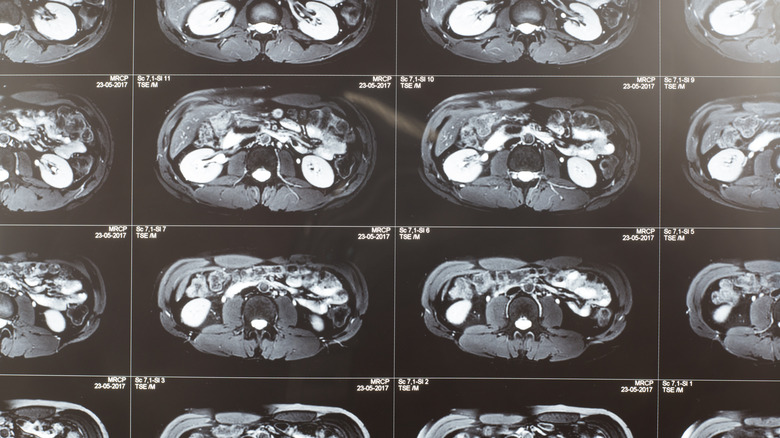 imaging of the abdomen