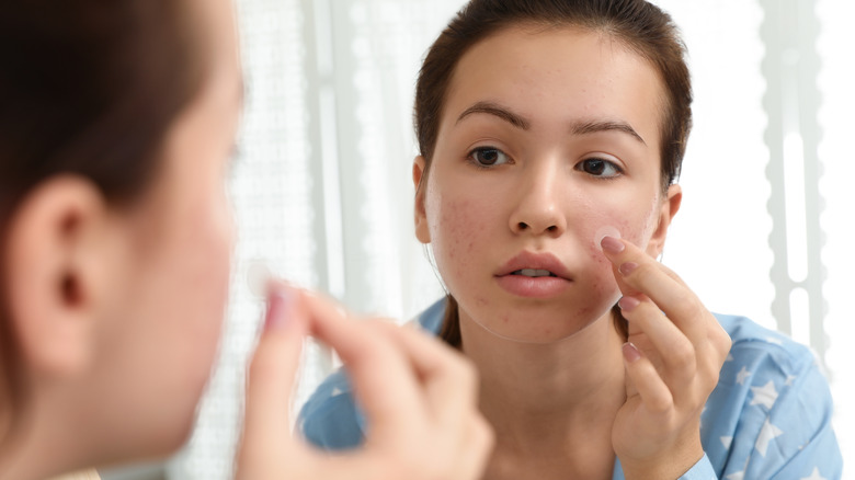 Young woman applying pimple patch on face