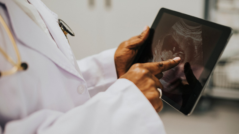 doctor pointing at ultrasound image on an iPad
