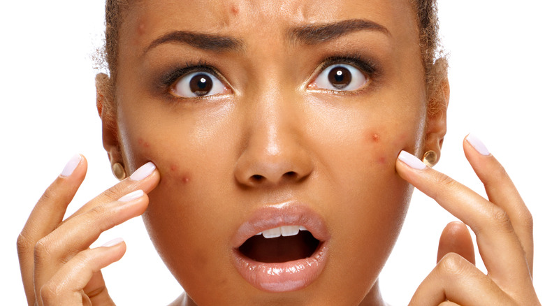 Close up of woman distressed by acne