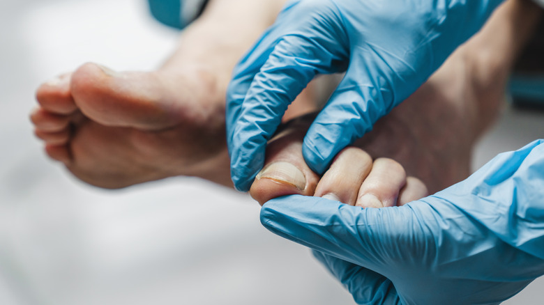 Doctor examining patient's toe