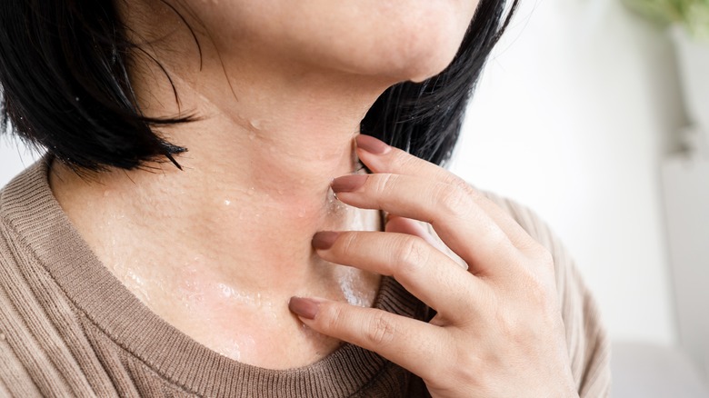 Woman with water allergy scratching her neck