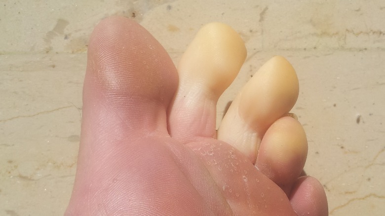 numb white toes up close