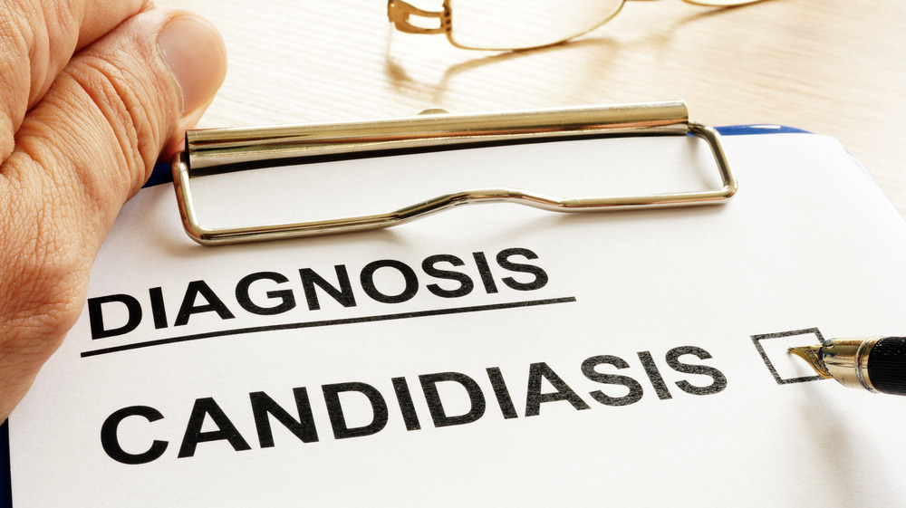 candidiasis diagnosis on paper