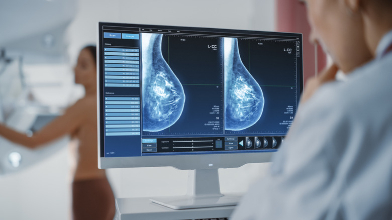 Breasts on a mammogram