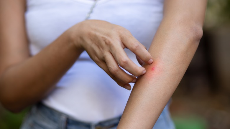 close up of woman scratching an itchy mosquito bite