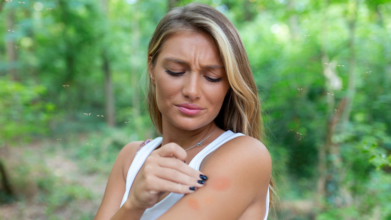 Woman frowning at bug bites
