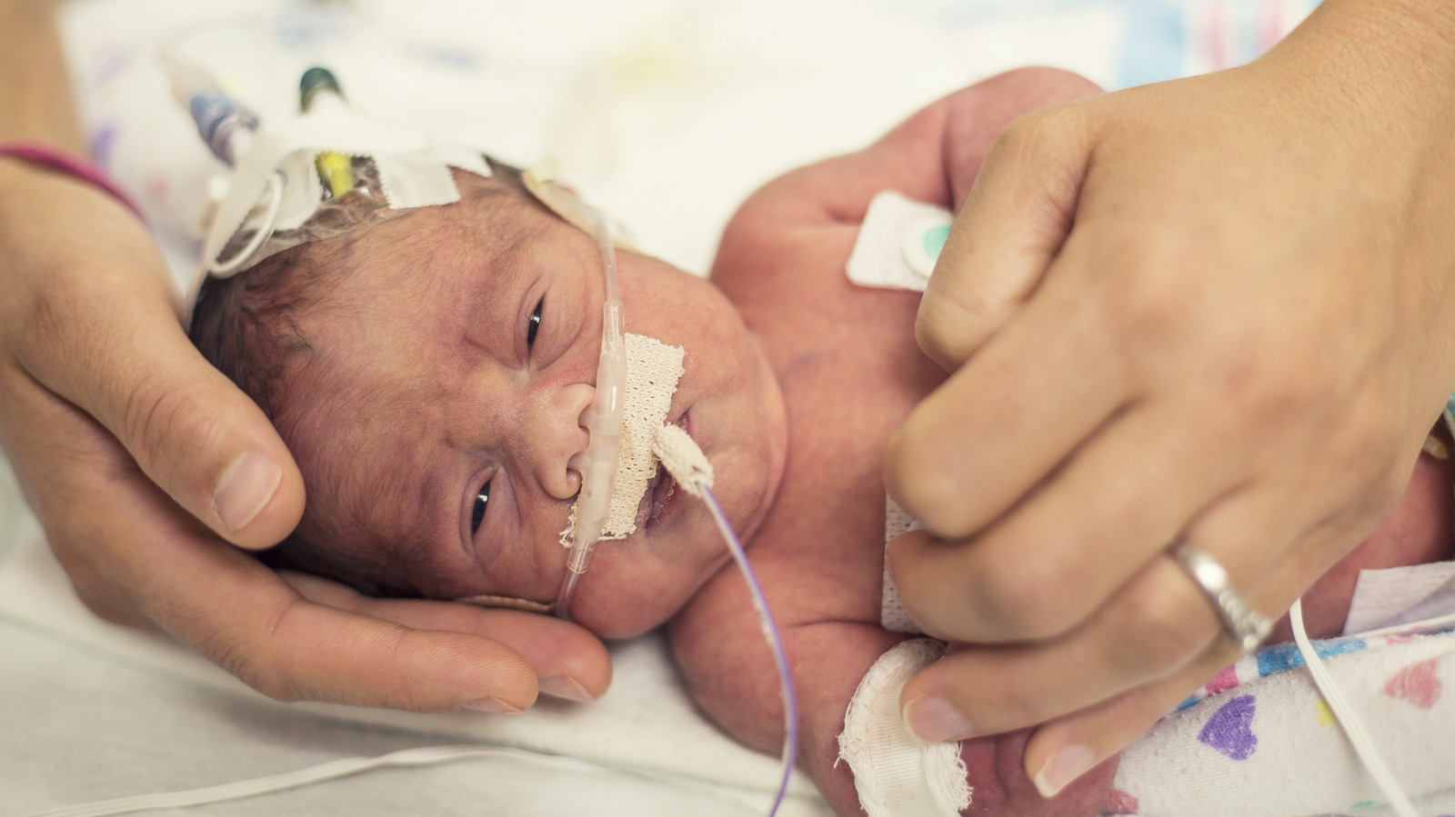 the-hidden-impact-of-premature-birth-on-adult-lung-health-a-call-for