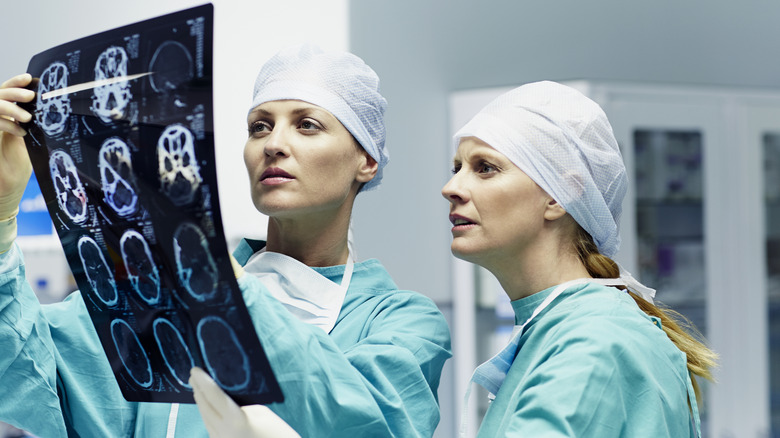 doctors looking at brain image scans