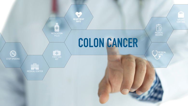 colon cancer sign