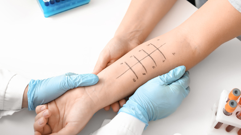 Woman undergoing allergy test on arm