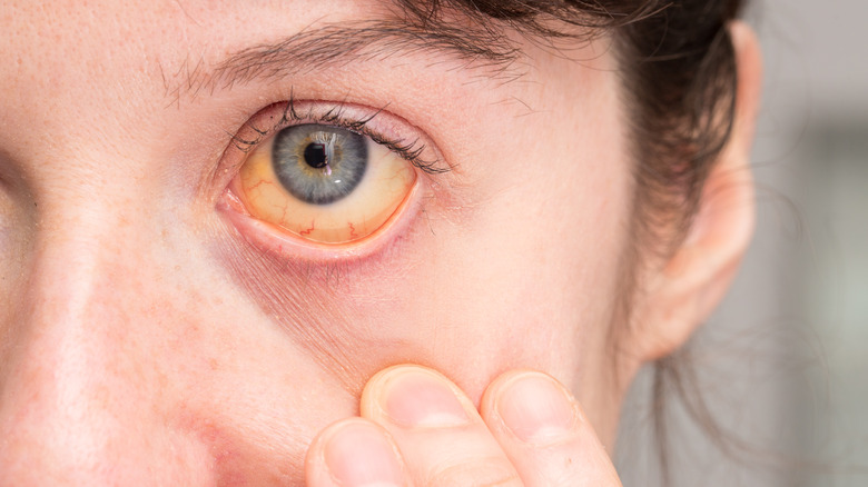 Close-up of a young woman with yellow eyes