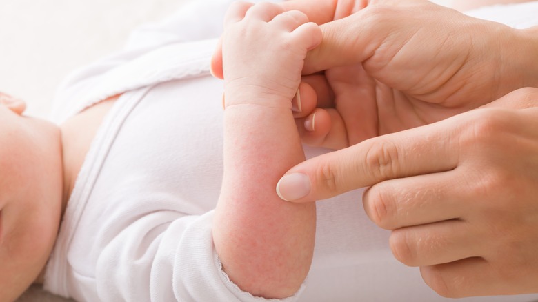 newborn with red rash