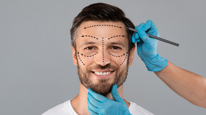 facial surgery prep