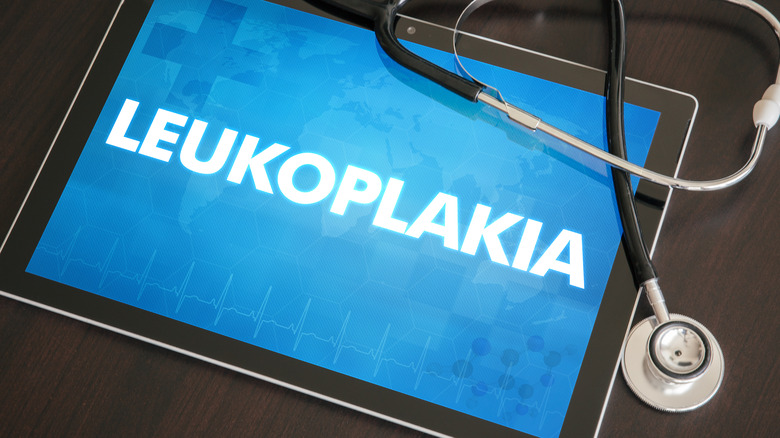 leukoplakia on tablet screen with stethoscope