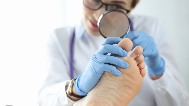 doctor examining a foot