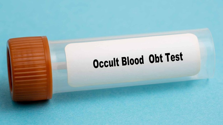 test tube labeled 'Occult Blood Obt Test'