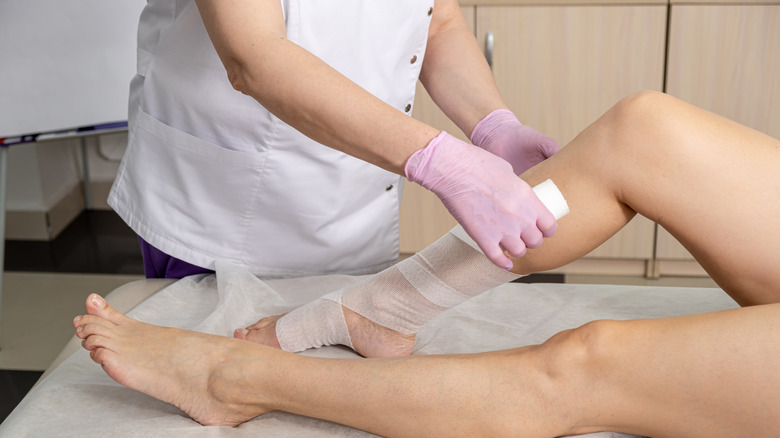 Wrapping leg with edema