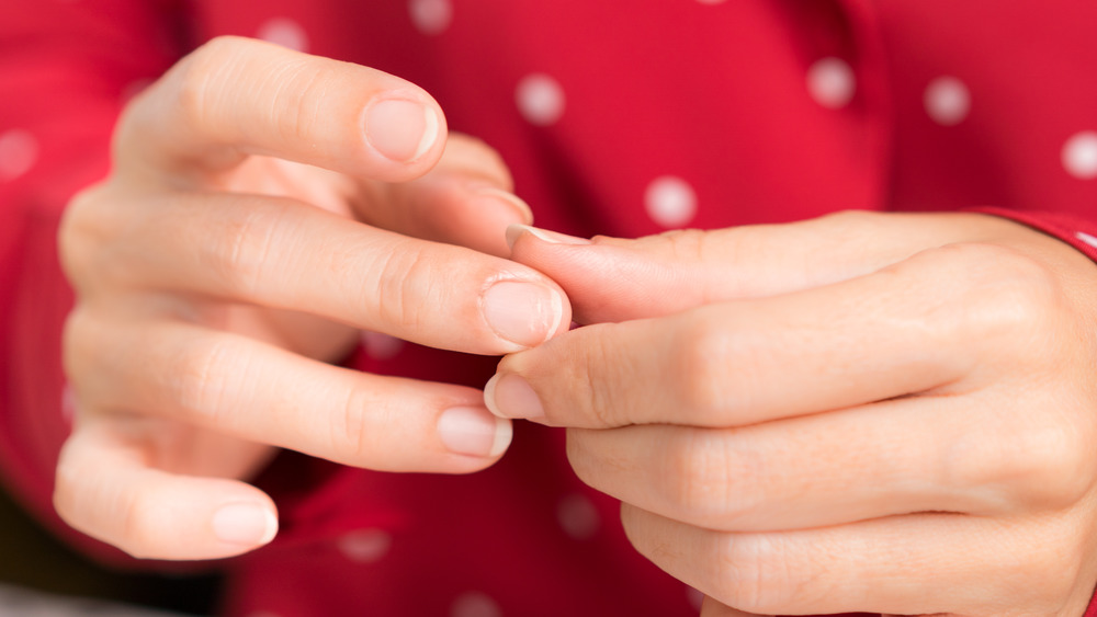 Hands with splitting nails