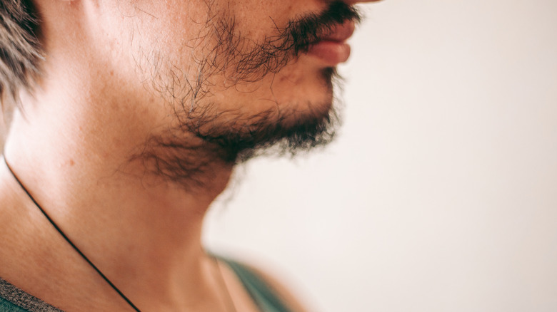 Man with patchy beard