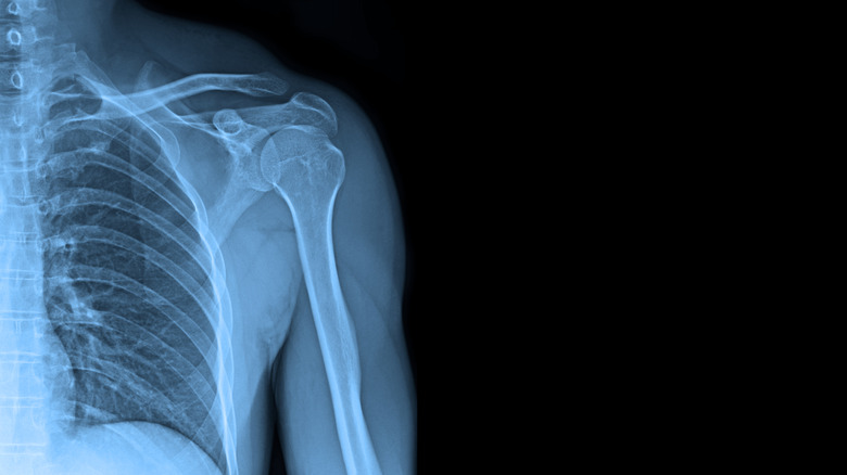 x ray of shoulder joint