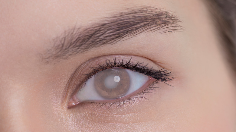 Close up of a woman's eye, which has a cataract, and her eyebrow