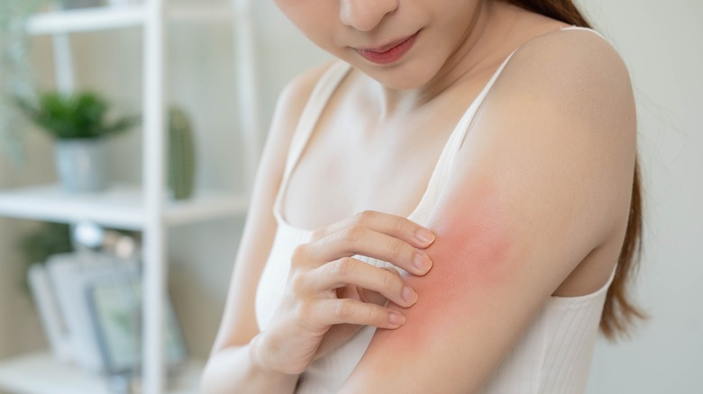 woman scratching her skin