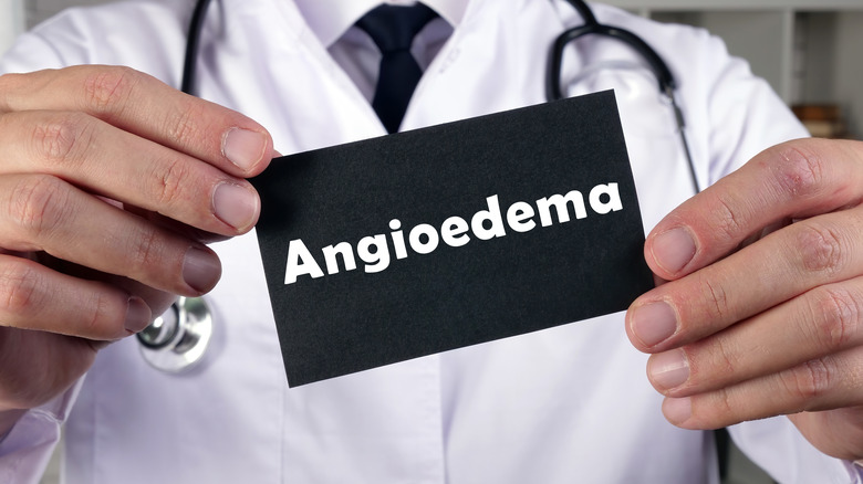 doctor in white coat holding card up that reads "angioedema"