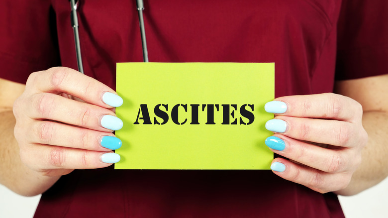 Medical professional holding card saying "ascites"