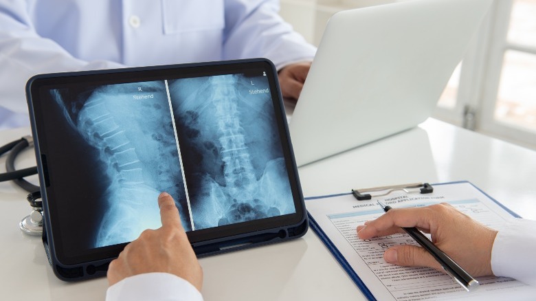 images of spine on tablet