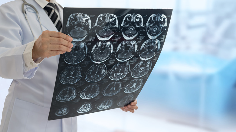 doctor looking at a sheet of head x-rays