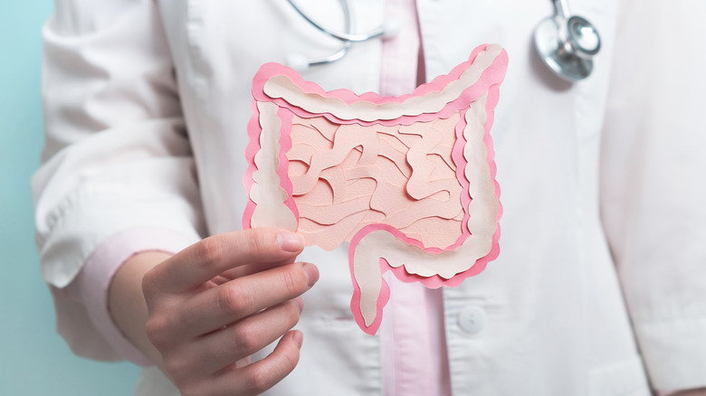 doctor holding image of digestive tract