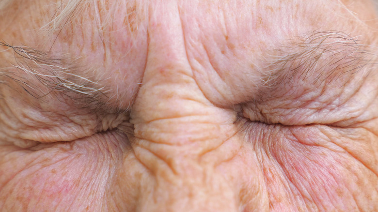 older person screwing up eyes
