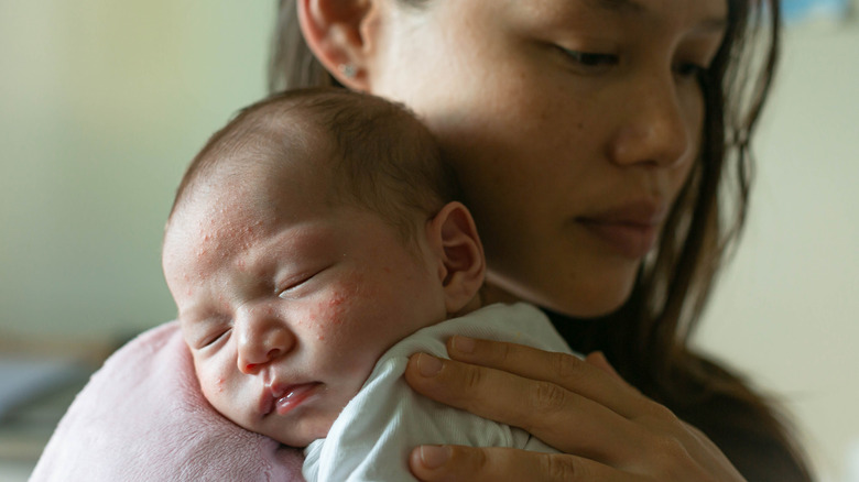 Mother and newborn with neonatal acne