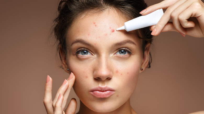 Woman applying acne spot treatment