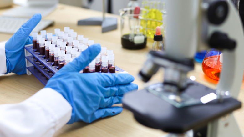 A lab technician's gloved hands handle a rack of test tubes with blood samples