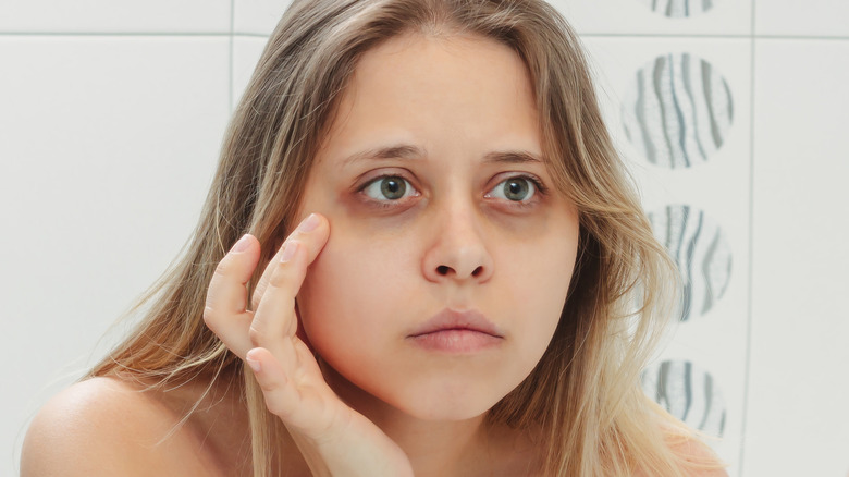 Woman with dark circles under eyes