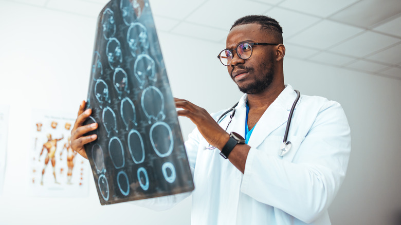 Doctor examining brain X-ray