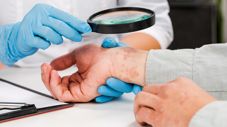 dermatologist examines rash