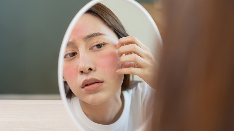 Woman looking at facial rash in mirror