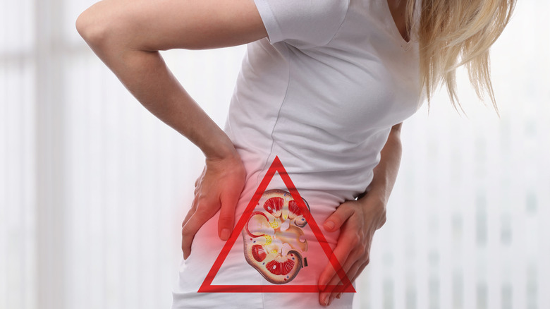 woman with kidney sone pain