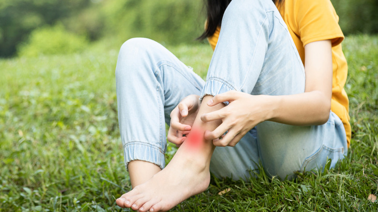 woman scratching her leg