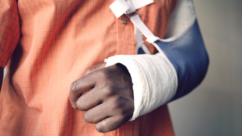 Closeup midsection of a man with broken arm in cast