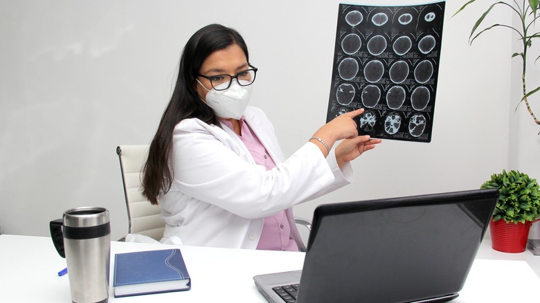 Neurologist showing scans of brain through a virtual appointment