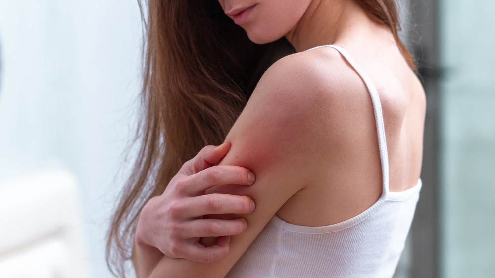 woman scratching a rash