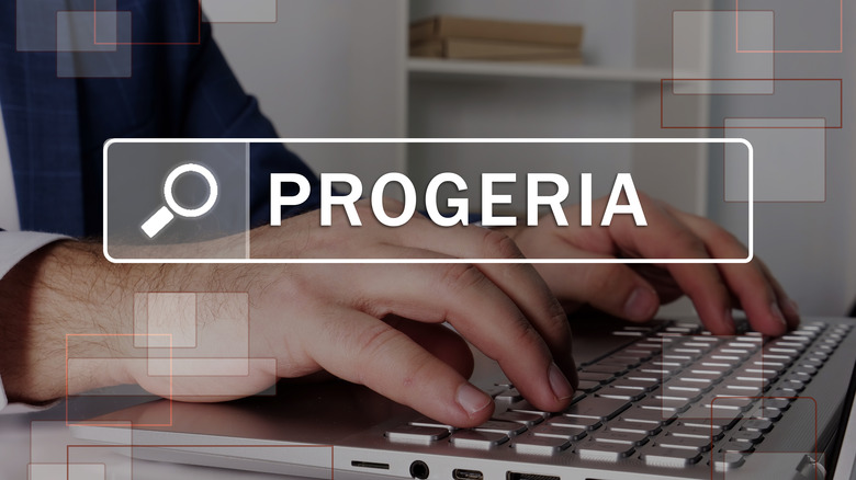 Close up of someone typing on a laptop with an overlay of the word PROGERIA in a search bar